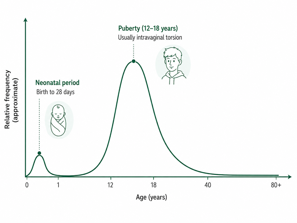 Schematic age-related frequency of testicular torsion